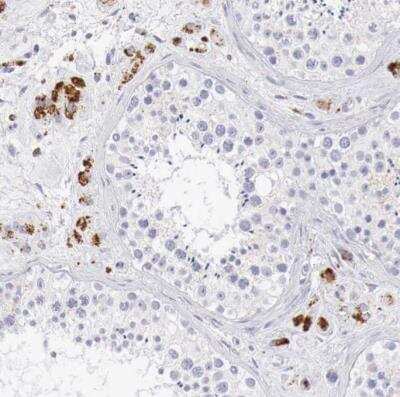 Immunohistochemistry-Paraffin: alpha-Galactosidase A/GLA Antibody [NBP1-89796]
