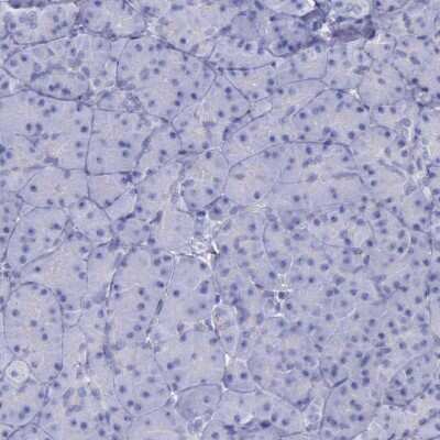 Immunohistochemistry-Paraffin: alpha-Galactosidase A/GLA Antibody [NBP1-89797]