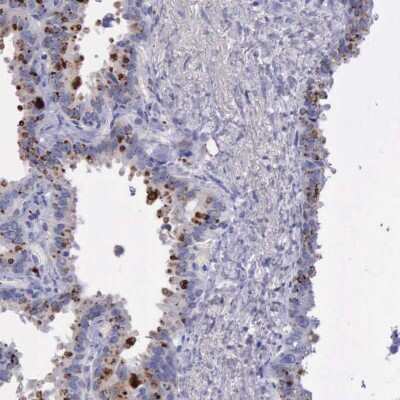 Immunohistochemistry-Paraffin: alpha-Galactosidase A/GLA Antibody [NBP1-89797]