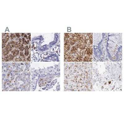 Immunohistochemistry-Paraffin: alpha-Galactosidase A/GLA Antibody [NBP1-89797]