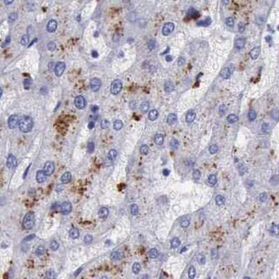 Immunohistochemistry-Paraffin: alpha-Galactosidase A/GLA Antibody [NBP1-89797]