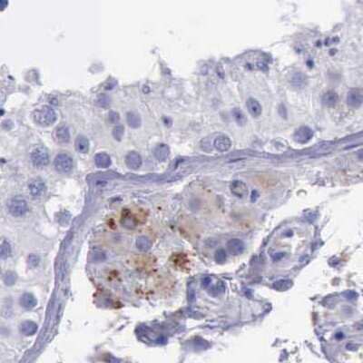 Immunohistochemistry-Paraffin: alpha-Galactosidase A/GLA Antibody [NBP1-89797]