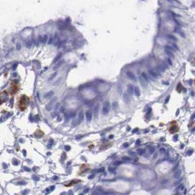 Immunohistochemistry-Paraffin: alpha-Galactosidase A/GLA Antibody [NBP1-89797]