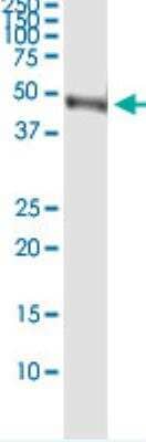 Immunoprecipitation: alpha-Galactosidase A/GLA Antibody [H00002717-D01]
