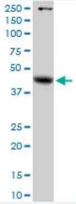 Western Blot: alpha-Galactosidase A/GLA Antibody [H00002717-D01]