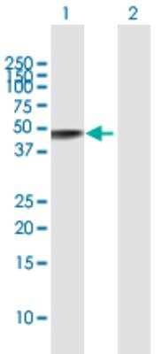 Western Blot: alpha-Galactosidase A/GLA Antibody [H00002717-D01]