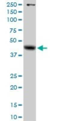 Western Blot: alpha-Galactosidase A/GLA Antibody [H00002717-D01P]