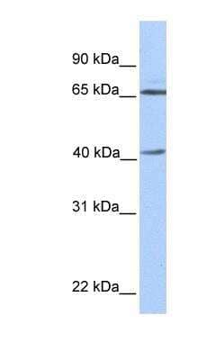 Western Blot: alpha-Galactosidase A/GLA Antibody [NBP1-58018]