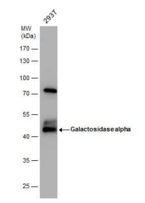 Western Blot: alpha-Galactosidase A/GLA Antibody [NBP2-16576]