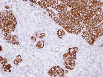 Immunohistochemistry-Paraffin: alpha Glucosidase 2 Antibody [NBP1-32554]