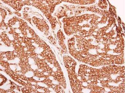 Immunohistochemistry-Paraffin: alpha Glucosidase 2 Antibody [NBP1-32554]