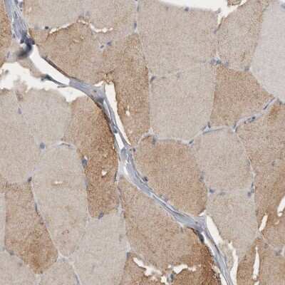 Immunohistochemistry-Paraffin: alpha Glucosidase 2 Antibody [NBP1-89806]