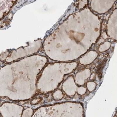 Immunohistochemistry-Paraffin: alpha Glucosidase 2 Antibody [NBP1-89806]