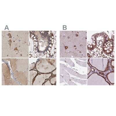 Immunohistochemistry-Paraffin: alpha Glucosidase 2 Antibody [NBP1-89806]