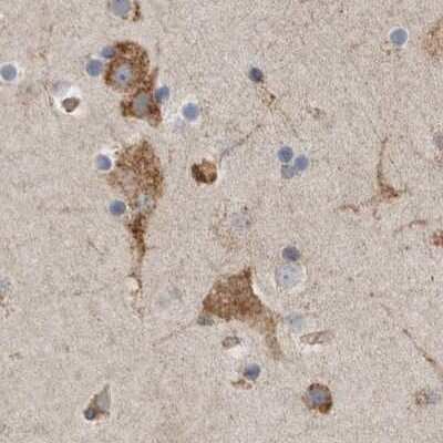 Immunohistochemistry-Paraffin: alpha Glucosidase 2 Antibody [NBP1-89806]