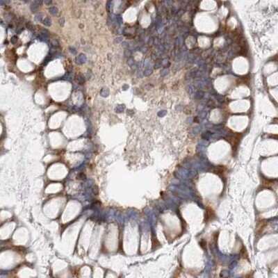 Immunohistochemistry-Paraffin: alpha Glucosidase 2 Antibody [NBP1-89806]