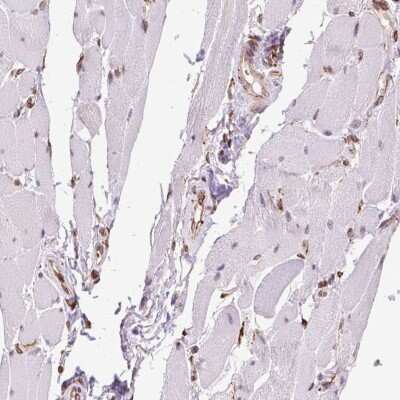 Immunohistochemistry-Paraffin: alpha Glucosidase 2 Antibody [NBP2-49332]