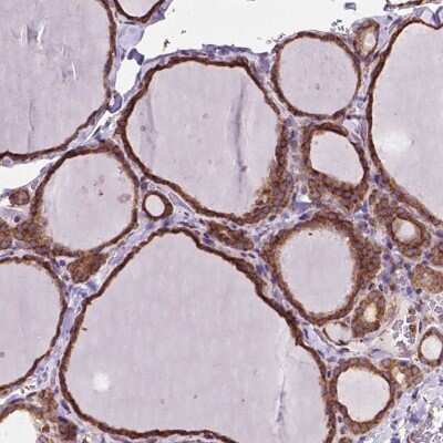 Immunohistochemistry-Paraffin: alpha Glucosidase 2 Antibody [NBP2-49332]
