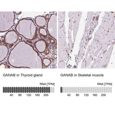 Immunohistochemistry-Paraffin: alpha Glucosidase 2 Antibody [NBP2-49332]