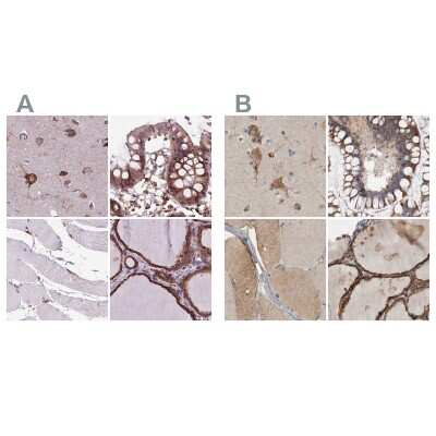 Immunohistochemistry-Paraffin: alpha Glucosidase 2 Antibody [NBP2-49332]
