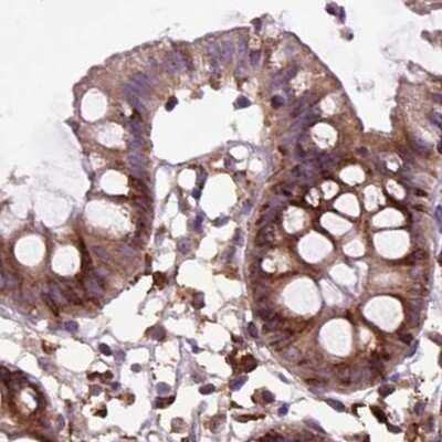 Immunohistochemistry-Paraffin: alpha Glucosidase 2 Antibody [NBP2-49332]