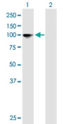 Western Blot: alpha Glucosidase 2 Antibody [H00023193-B01P]