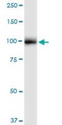 Western Blot: alpha Glucosidase 2 Antibody [H00023193-D01P]