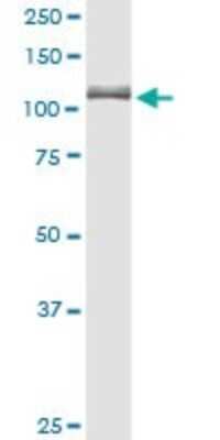 Western Blot: alpha Glucosidase 2 Antibody [H00023193-D01P]