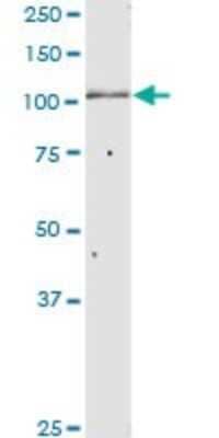 Western Blot: alpha Glucosidase 2 Antibody [H00023193-D01P]