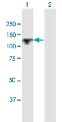 Western Blot: alpha Glucosidase 2 Antibody [H00023193-D01P]