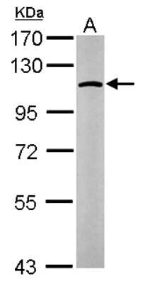 Western Blot: alpha Glucosidase 2 Antibody [NBP1-32554]