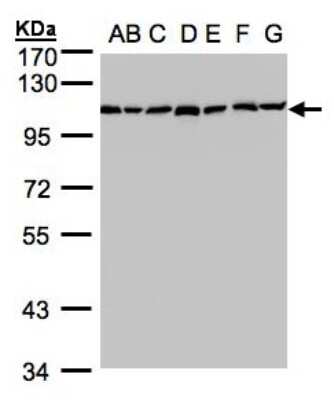Western Blot: alpha Glucosidase 2 Antibody [NBP1-32554]