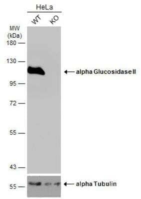 Western Blot: alpha Glucosidase 2 Antibody [NBP1-32554]