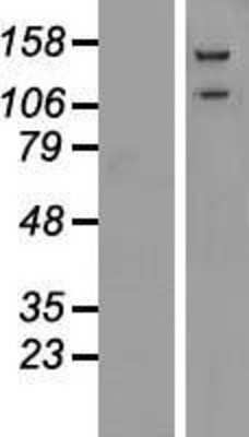 Western Blot: alpha Glucosidase 2 Overexpression Lysate [NBP2-04726]