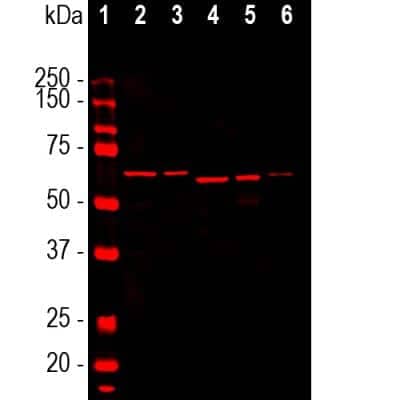 Western Blot: alpha-Internexin Antibody (2E3) [NB300-140]