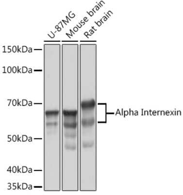 Western Blot: alpha-Internexin Antibody (5E5Z3) [NBP3-16230]