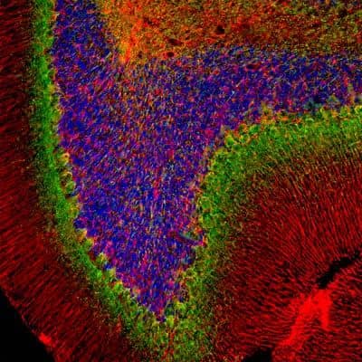 Immunohistochemistry: alpha-Internexin Antibody [NB300-139]