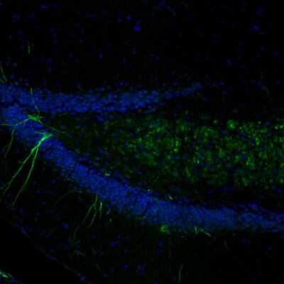 Immunohistochemistry-Paraffin: alpha-Internexin Antibody [NBP1-81007]