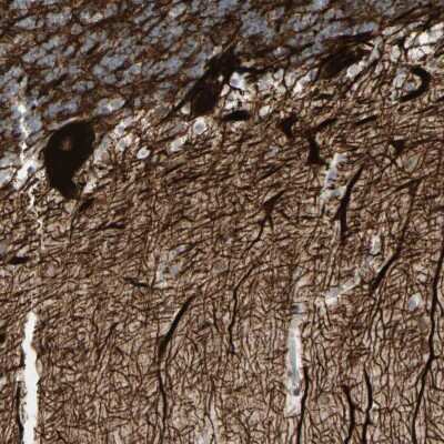 Immunohistochemistry-Paraffin: alpha-Internexin Antibody [NBP1-81007]