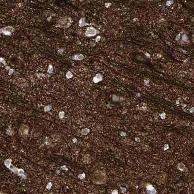 Immunohistochemistry-Paraffin: alpha-Internexin Antibody [NBP1-81007]