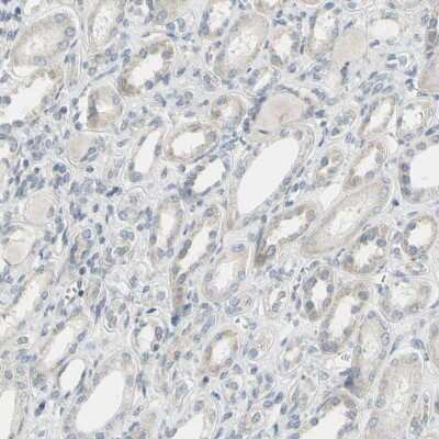 Immunohistochemistry-Paraffin: alpha-Internexin Antibody [NBP1-81007]