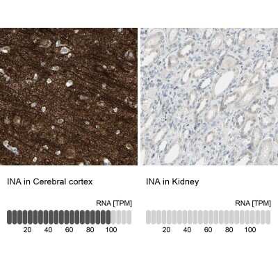 Immunohistochemistry-Paraffin: alpha-Internexin Antibody [NBP1-81007]