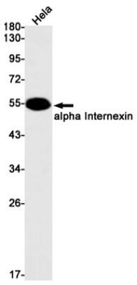 Western Blot: alpha-Internexin Antibody (S03-6H1) [NBP3-19567]