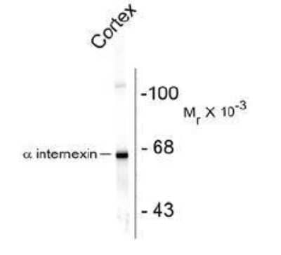 Western Blot: alpha-Internexin Antibody [NB110-93355]