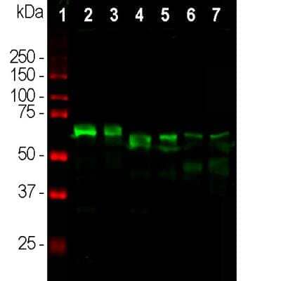 Western Blot: alpha-Internexin Antibody [NBP1-05208]