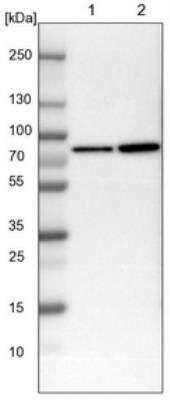 Western Blot: alpha-Internexin Antibody [NBP1-81007]