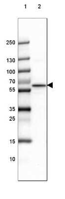 Western Blot: alpha-Internexin Antibody [NBP1-81007]