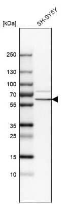 Western Blot: alpha-Internexin Antibody [NBP1-81007]