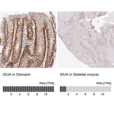 Immunohistochemistry-Paraffin: alpha-L-Iduronidase/IDUA Antibody [NBP2-49126]
