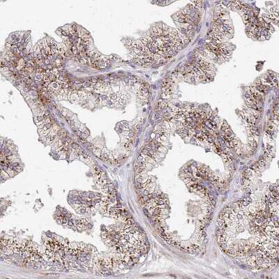 Immunohistochemistry-Paraffin: alpha-L-Iduronidase/IDUA Antibody [NBP2-49126]